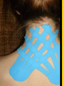  Kinesiotaping Dębica